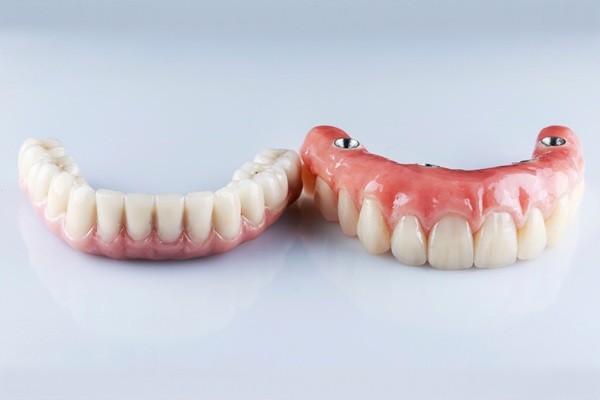 Essential Things To Know About All On Dental Implants