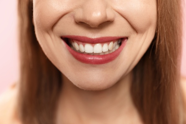 A Step By Step Guide To Implant Restoration