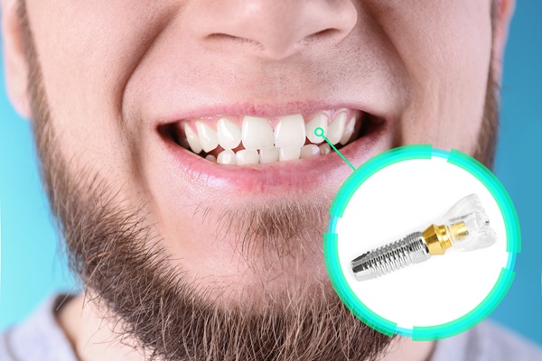 Your Tooth Replacement Options